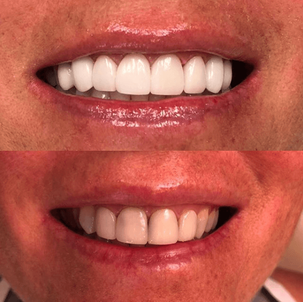 Smile gallery
