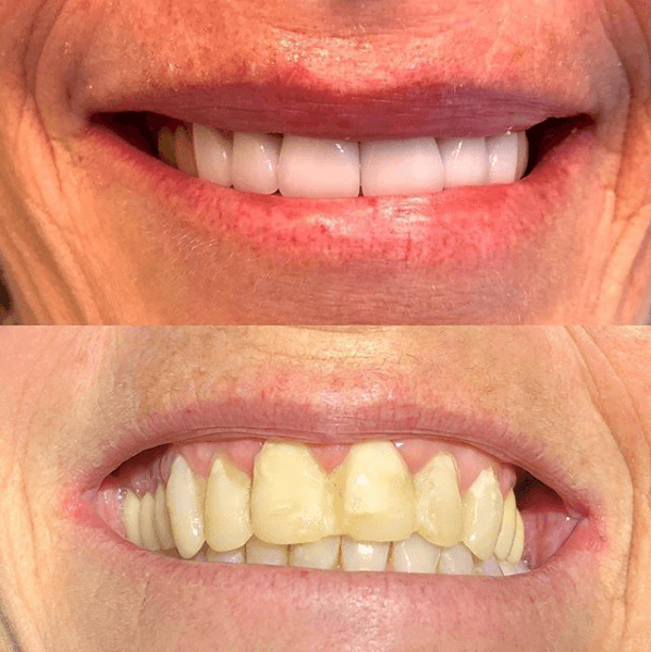 Smile gallery